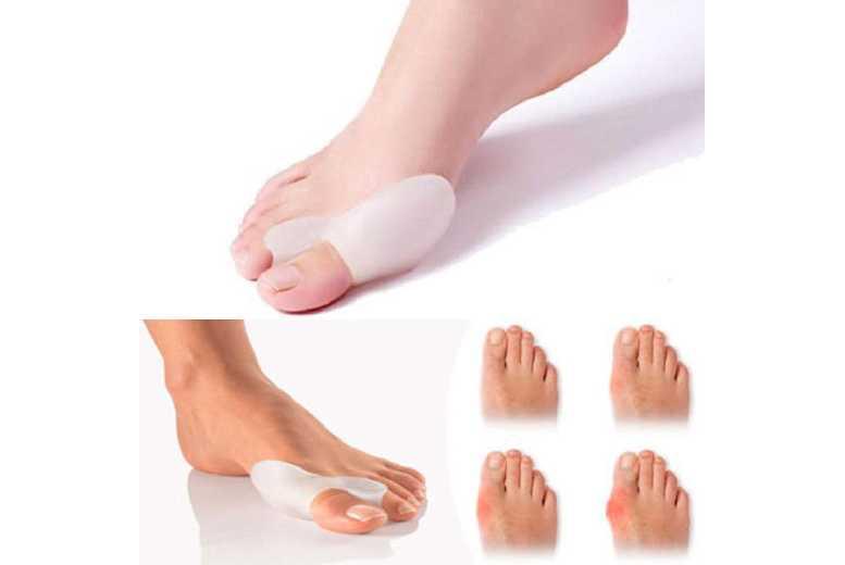 Silicone Bunion Toe Correctors - Foot Alignment Gel Pads For Relief & Comfort, For All Skin Types