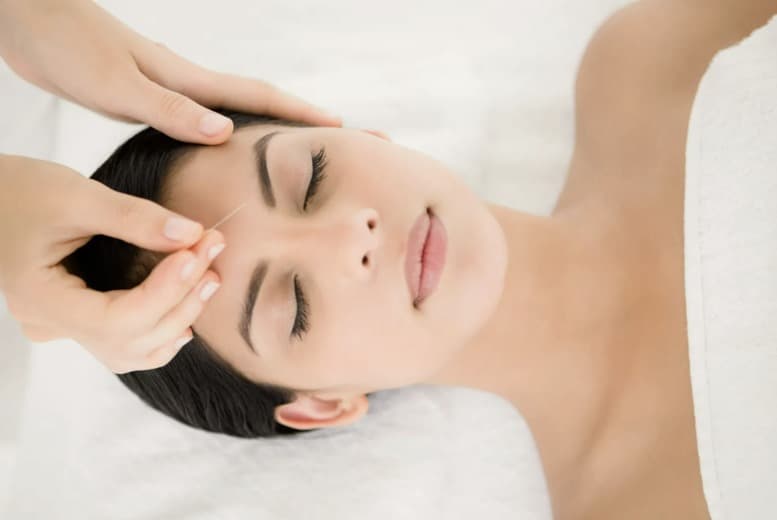 Ordinary, Fine, Or Luxury Carving Cosmetic Acupuncture - 60-Minute Session At Acupuncture And Beauty, Phibsborough, Dublin