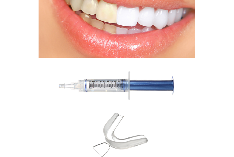 Brilliant Smile Teeth Whitening Kit - Non-Peroxide Gel, Custom Tray, Fast-Acting Formula