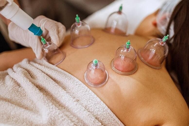 Cupping Therapy Spa Experience - Choice Of Cupping Treatment, Consultation & Aftercare At Good Place Clinic & Spa, Dublin